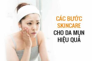 Tìm hiểu kỹ các bước skincare cho da mụn