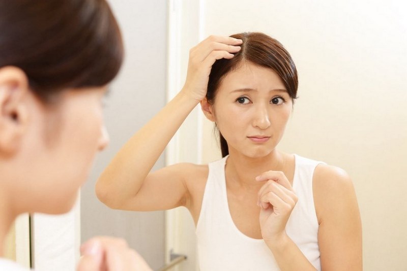Rụng tóc gây ra sự tự ti, ảnh hưởng cuộc sống